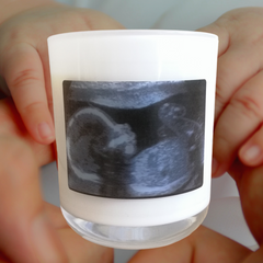 Design Your Own | Personalised | BABY SCAN | Photo | Boxed Soy Candle | New Baby | Mum To Be